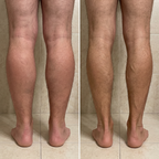 Chaussettes compression BAZE